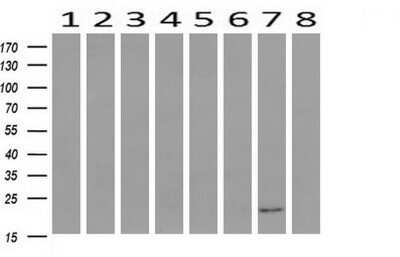 Western Blot: HRAS Antibody (OTI1D9)Azide and BSA Free [NBP2-74847]