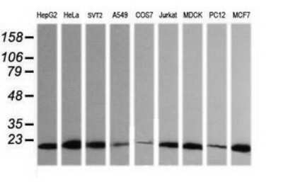 Western Blot: HRAS Antibody (OTI1D9)Azide and BSA Free [NBP2-74847]