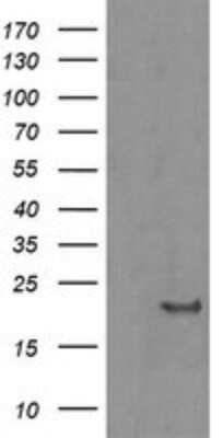 Western Blot: HRAS Antibody (OTI1D9)Azide and BSA Free [NBP2-74847]