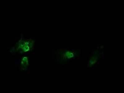 Immunofluorescence: HRAS Antibody (OTI1D9) [NBP2-45745]