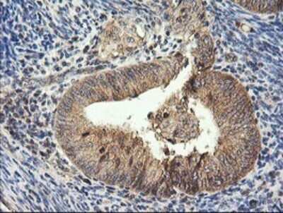 Immunohistochemistry: HRAS Antibody (OTI1D9) [NBP2-45745]
