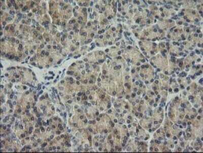 Immunohistochemistry: HRAS Antibody (OTI1D9) [NBP2-45745]