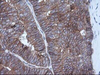 Immunohistochemistry: HRAS Antibody (OTI1D9) [NBP2-45745]