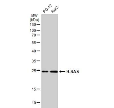 Western Blot: HRAS Antibody [NBP2-42864]