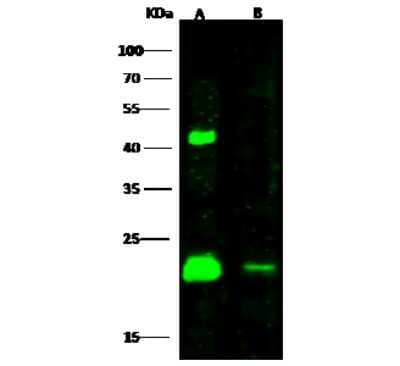 Western Blot: HRAS Antibody [NBP2-99921]