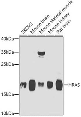 Western Blot: HRAS AntibodyBSA Free [NBP3-04117]