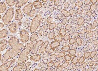 Immunohistochemistry-Paraffin: HRAS like suppressor Antibody [NBP3-05960]