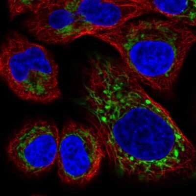 Immunocytochemistry/ Immunofluorescence: HRASLS2 Antibody [NBP2-31737]