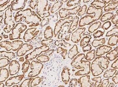 Immunohistochemistry-Paraffin: HRASLS2 Antibody [NBP3-06348]