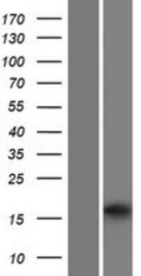 Western Blot: HRASLS2 Overexpression Lysate [NBP2-06910]