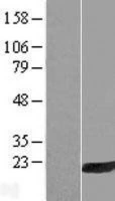 Western Blot: PLA2G16/HRASLS3 Overexpression Lysate [NBL1-11704]