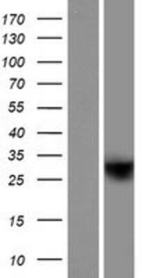 Western Blot: HRASLS5 Overexpression Lysate [NBP2-05808]