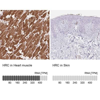 Immunohistochemistry-Paraffin: HRC Antibody [NBP1-81208]