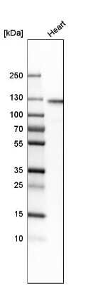 Western Blot: HRC Antibody [NBP1-81208]