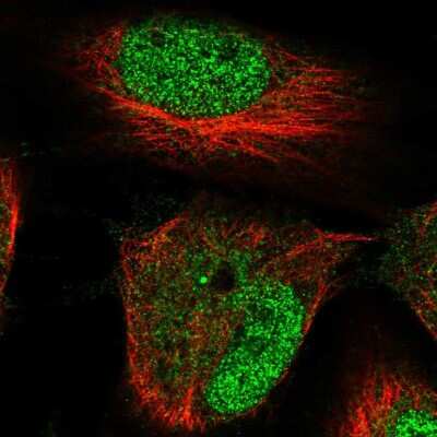 Immunocytochemistry/ Immunofluorescence: HRCT1 Antibody [NBP2-57742]