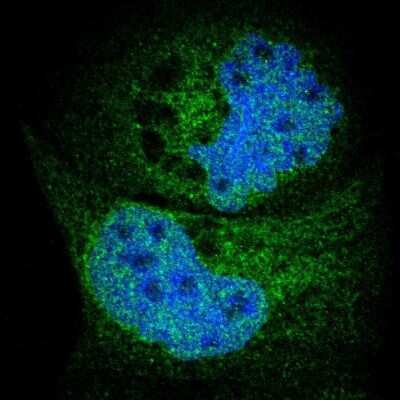 Immunocytochemistry/ Immunofluorescence: HRD1 Antibody [NBP1-89667]