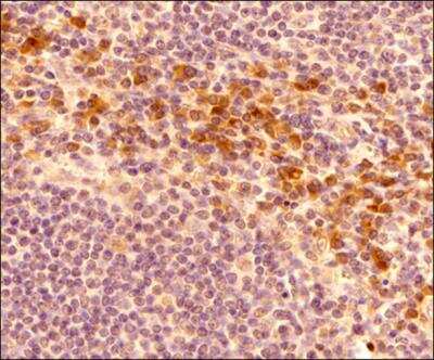 Immunohistochemistry-Paraffin: HRD1 Antibody - BSA Free [NB100-2526]