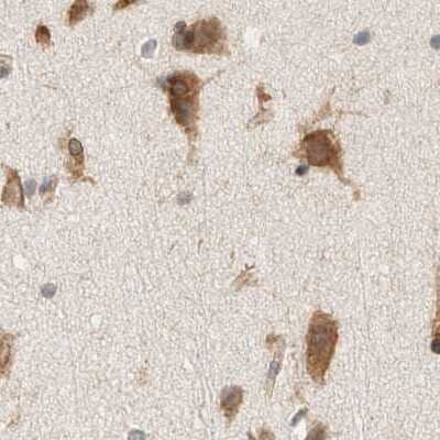 Immunohistochemistry-Paraffin: HRD1 Antibody [NBP1-89668]