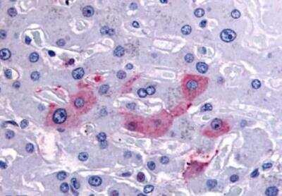 Immunohistochemistry-Paraffin: HRD1 Antibody - BSA Free [NBP3-06671]