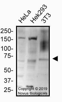 Western Blot: HRD1 AntibodyBSA Free [NB100-2526]