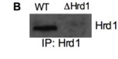 Western Blot: HRD1 AntibodyBSA Free [NB100-2526]