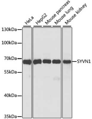 Western Blot: HRD1 AntibodyBSA Free [NBP3-02998]