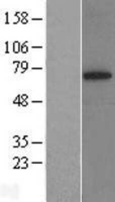 Western Blot: HRD1 Overexpression Lysate [NBL1-16659]