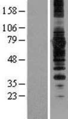 Western Blot: HRD1 Overexpression Lysate [NBL1-16660]