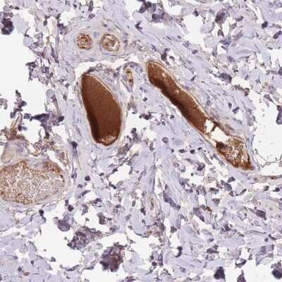 Immunohistochemistry-Paraffin: HPRG Antibody [NBP2-33594]