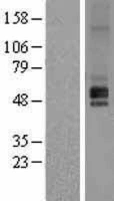 Western Blot: Histamine H1R Overexpression Lysate [NBP2-08305]