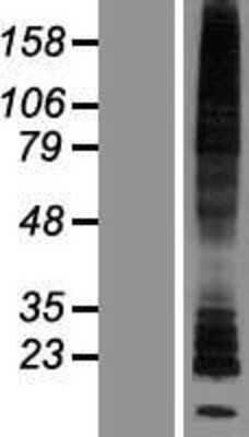 Western Blot: Histamine H2R Overexpression Lysate [NBP2-06453]