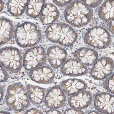 Immunohistochemistry-Paraffin: HROB Antibody [NBP1-93494]