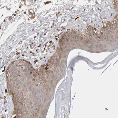Immunohistochemistry-Paraffin: HROB Antibody [NBP1-93494]
