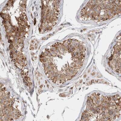 Immunohistochemistry-Paraffin: HROB Antibody [NBP1-93494]