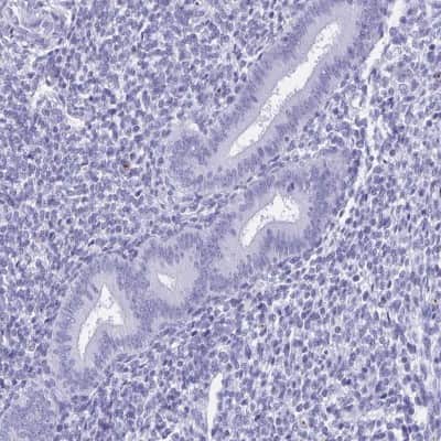 Immunohistochemistry-Paraffin: HRP-1/HDGFL1 Antibody [NBP2-14086]