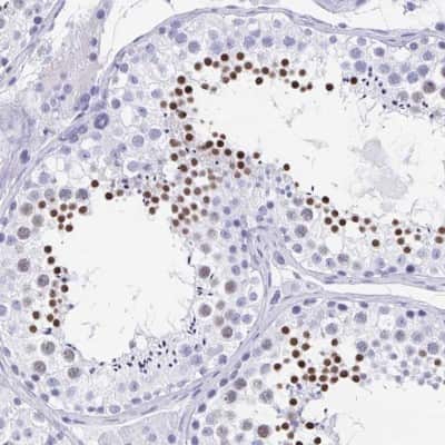 Immunohistochemistry-Paraffin: HRP-1/HDGFL1 Antibody [NBP2-14086]
