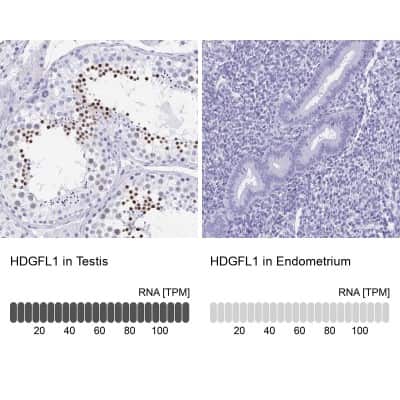 Immunohistochemistry-Paraffin: HRP-1/HDGFL1 Antibody [NBP2-14086]