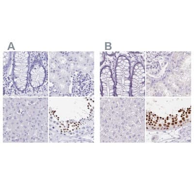 Immunohistochemistry-Paraffin: HRP-1/HDGFL1 Antibody [NBP2-14086]