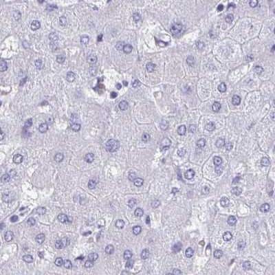 Immunohistochemistry-Paraffin: HRP-1/HDGFL1 Antibody [NBP2-14086]