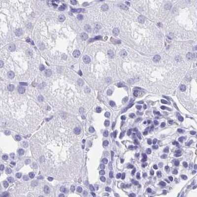 Immunohistochemistry-Paraffin: HRP-1/HDGFL1 Antibody [NBP2-14086]