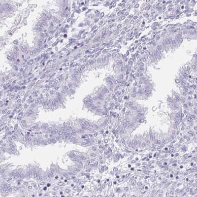 Immunohistochemistry-Paraffin: HRP-1/HDGFL1 Antibody [NBP2-39001]