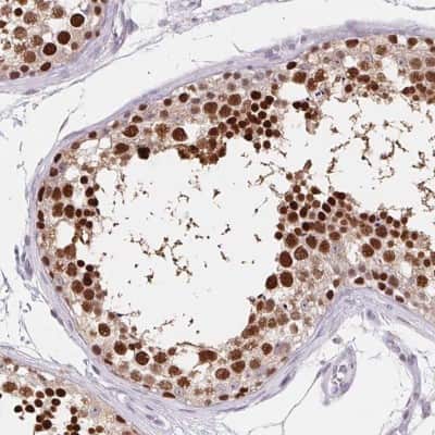 Immunohistochemistry-Paraffin: HRP-1/HDGFL1 Antibody [NBP2-39001]