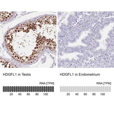Immunohistochemistry-Paraffin: HRP-1/HDGFL1 Antibody [NBP2-39001]