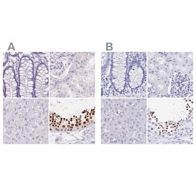 Immunohistochemistry-Paraffin: HRP-1/HDGFL1 Antibody [NBP2-39001]