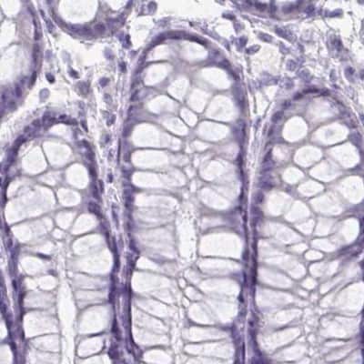 Immunohistochemistry-Paraffin: HRP-1/HDGFL1 Antibody [NBP2-39001]