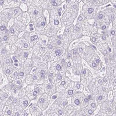 Immunohistochemistry-Paraffin: HRP-1/HDGFL1 Antibody [NBP2-39001]