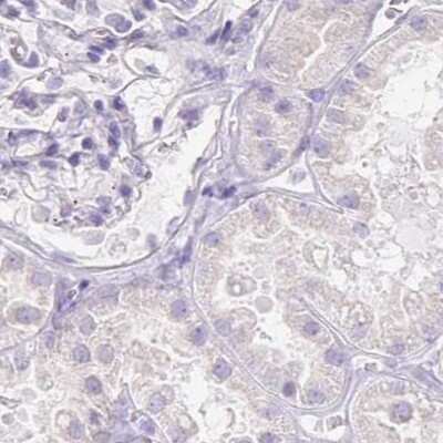 Immunohistochemistry-Paraffin: HRP-1/HDGFL1 Antibody [NBP2-39001]