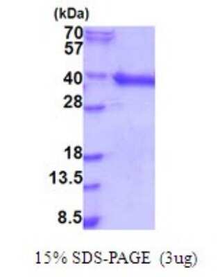 SDS-PAGE: Recombinant Human HRP-1/HDGFL1 His Protein [NBP2-51890]