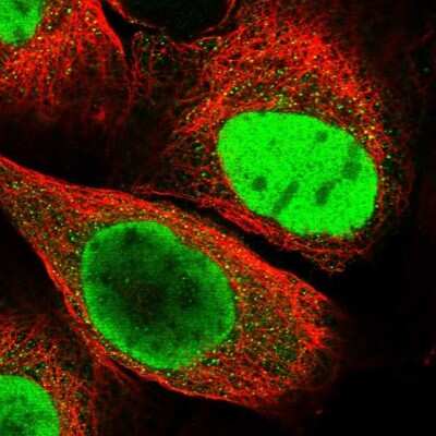 Immunocytochemistry/ Immunofluorescence: HRP-2 Antibody [NBP2-47437]