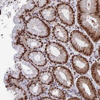 Immunohistochemistry: HRP-2 Antibody [NBP2-47437]